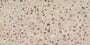 Stucco