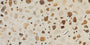 Stucco
